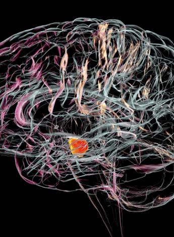 Radiographic image of a brain